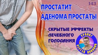 Голодание для мужского здоровья | Простатит, аденома - скрытые эффекты лечебного голодания.