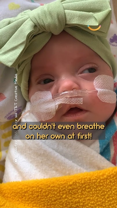 she-was-so-small-her-nano-preemie-diapers-fit-a-barbie-shorts
