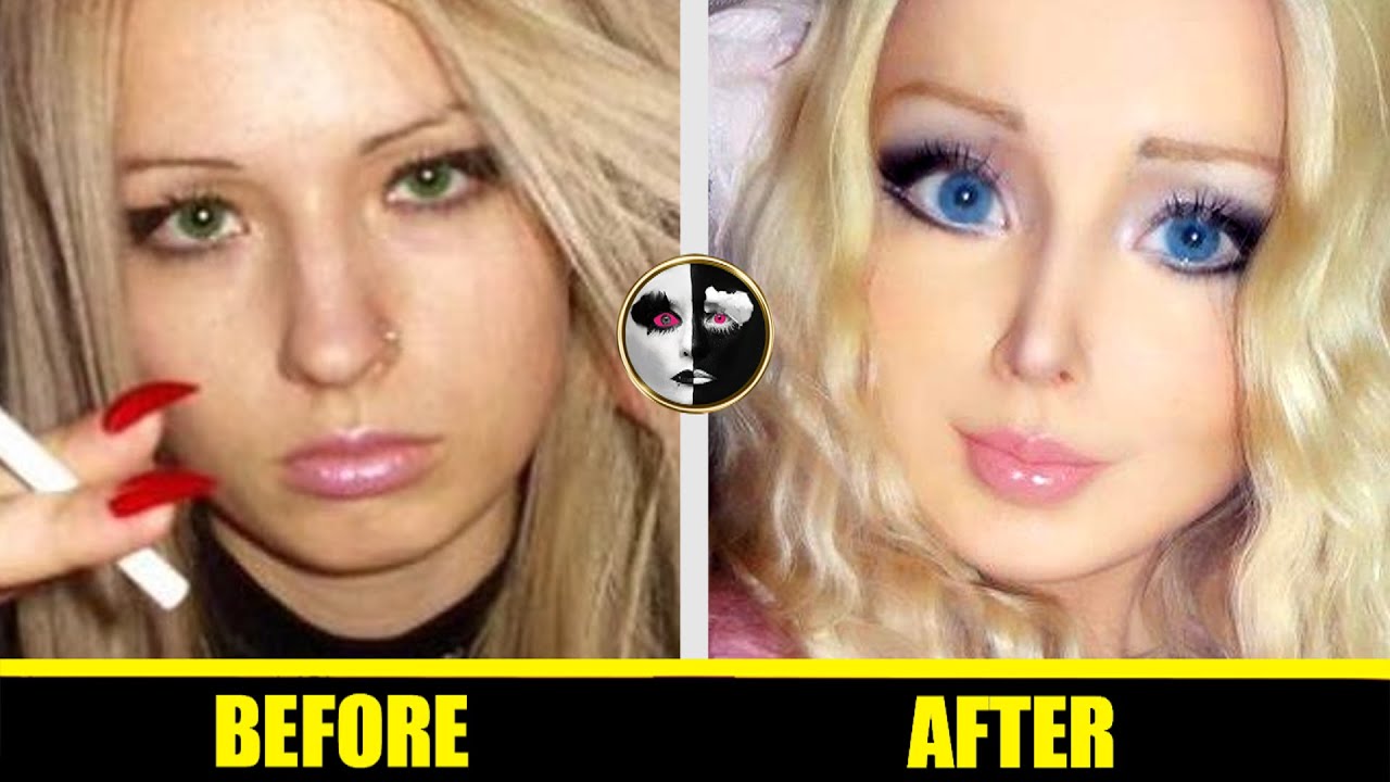 Valeria Lukyanova Barbie Doll Plastic Surgery Before And After