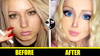 Valeria Lukyanova - 👧 Barbie Doll Plastic Surgery Before and After 👧 - ( Hot Beautiful Girls )