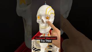 Vestibular Migraines Try THIS!
