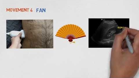 Basic transducer movements: Point of care ultrasonography by Dr Koratala (@NephroP)