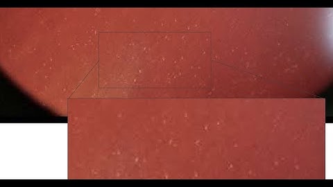 1 Slide in 5 Minutes: Fuchs