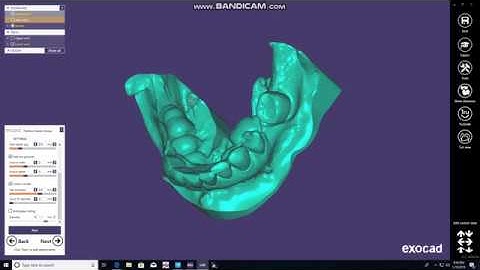 Making Models in Exocad from Trios Impressions