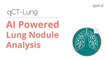 qCT-Lung - AI Powered Lung Nodule Analysis
