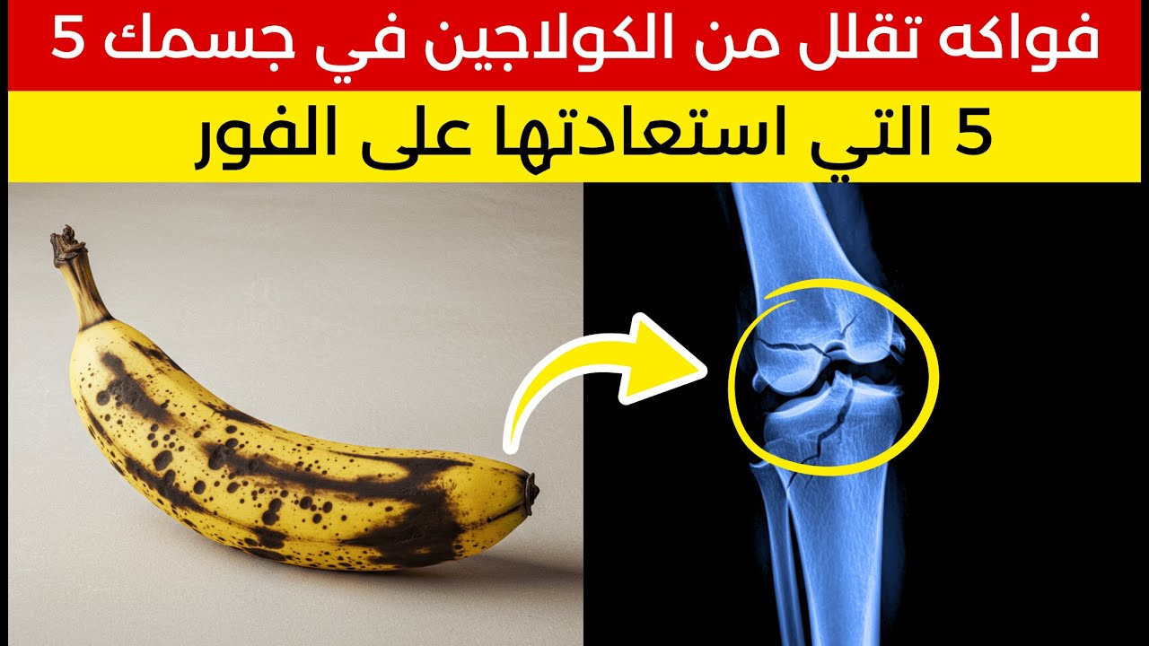 خطر على كبار السن! هذه الفاكهة تهدم الكولاجين في الجسم.