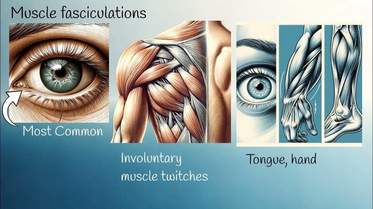 Muscle twitching when to worry about als and other serious conditions