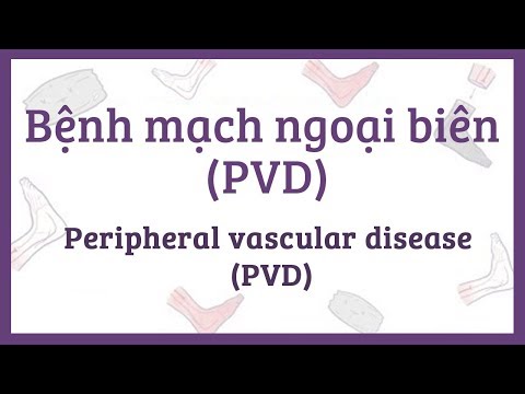 Bệnh mạch ngoại biên (PVD) - nguyên nhân, triệu chứng & bệnh lý
