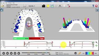 Getting Quality Scans with T-Scan