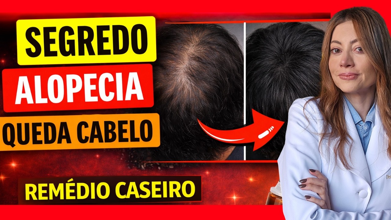 Лучшее домашнее средство от выпадения волос и алопеции, волосы растут за 2 недели! 🌿