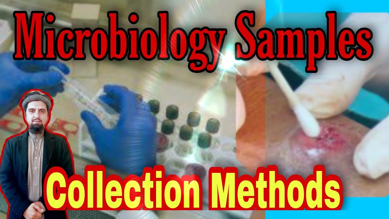 Basics of Microbiology Specimen collection Elearnwith Zakir YouTube