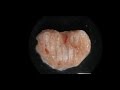 Bioprinting Bone Precursors