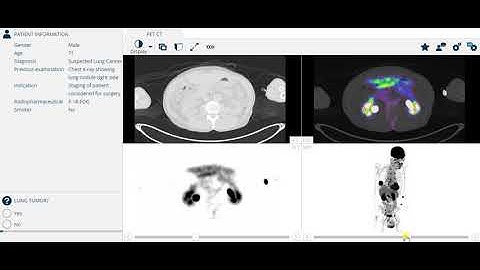 DICOM viewer