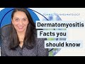 Dermatomyositis facts your rheumatologist wants you to know