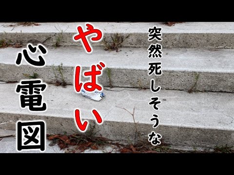 心電図　突然死　急死しそうな心電図　心臓専門医　米山喜平