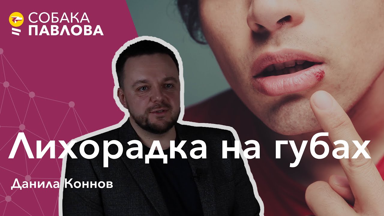 Лихорадка на губах - Данила Коннов//вирус простого герпеса, везикулы, генитальный герпес, ацикловир