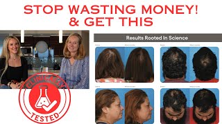 Thinning Hair? THIS WORKS! | Clinically Proven -PLATED SKIN SCIENCE HAIR SERUM