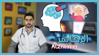 الزهايمر او مرض النسيان اسبابه وطرق الوقاية والعلاج