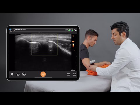 Image of Rheumatologic Ultrasound of the Lateral Elbow