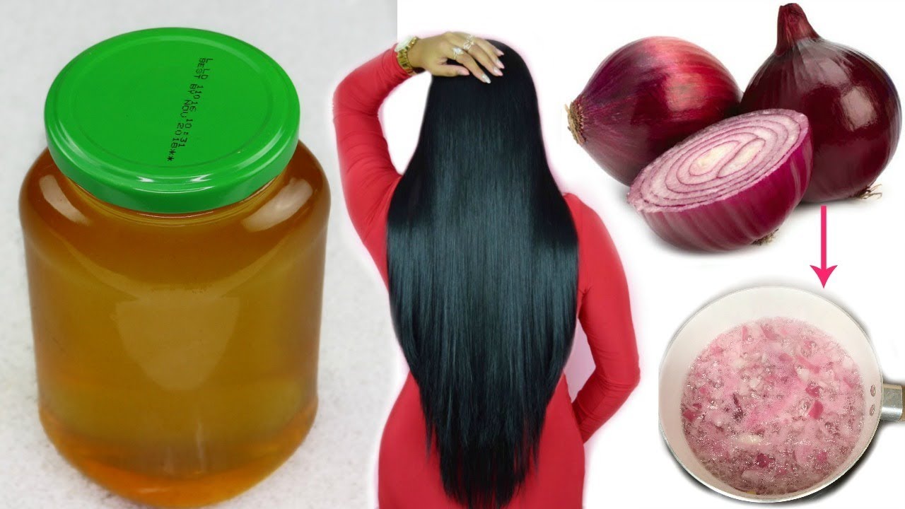 Aceite Cebolla Casero:Crecimiento extremo del cabello Dias| la Caida#2fashionbycarol - YouTube