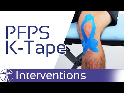 Kinesio Taping for PFPS | Patellofemoral Pain Syndrome