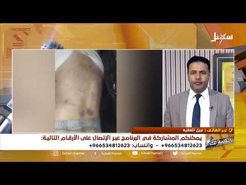 الكلمة لك | القتل تحت التعذيب... جرائم حوثية مستمرة
