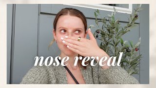 VLOG: nose reveal (!!!!!) + a full week of recovery