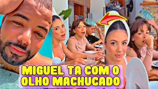 Miguel Ta Com O Olho Machucado Hytalo Anúncio Que Hoje E O Último Dia Na Casa