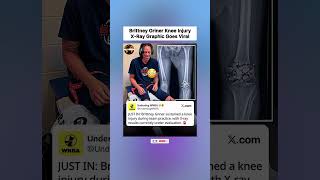 Brittney Griner Knee X-Ray Graphic Goes Viral 😳😂 #shorts