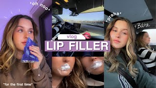 LIP FILLER VLOG | faily, nákupy & Praha