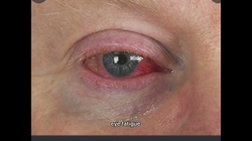 KOM4562 : Social Media Addiction Among Students (Group 5)