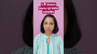 5 Best Stretch Marks Cream  #bengalivlog #beapositivemom #viral