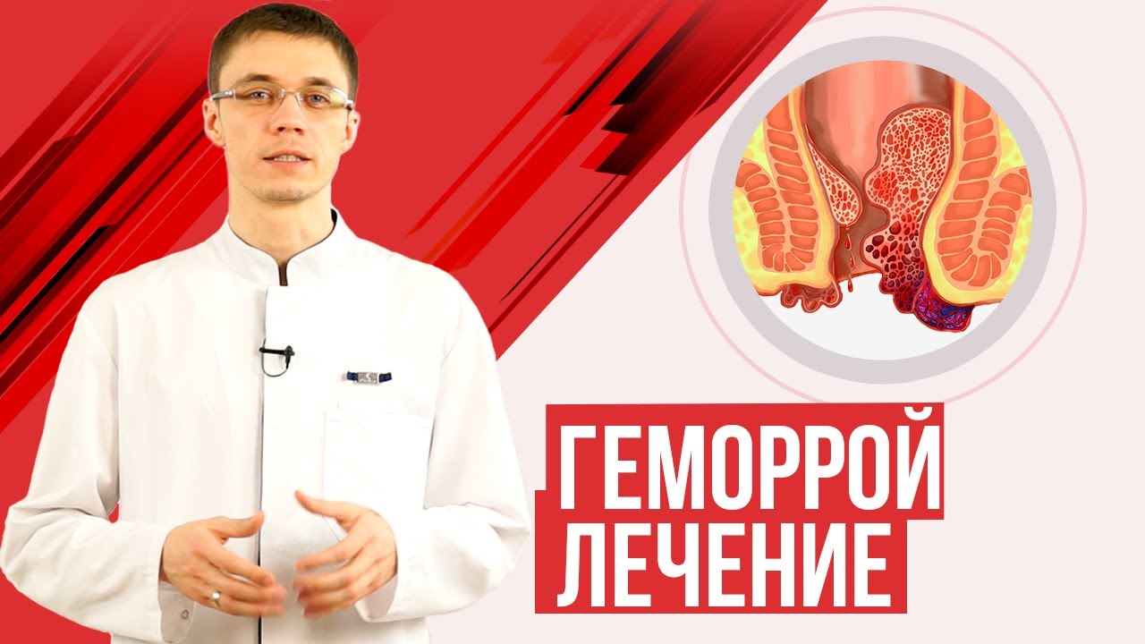 Лечение геморроя 4