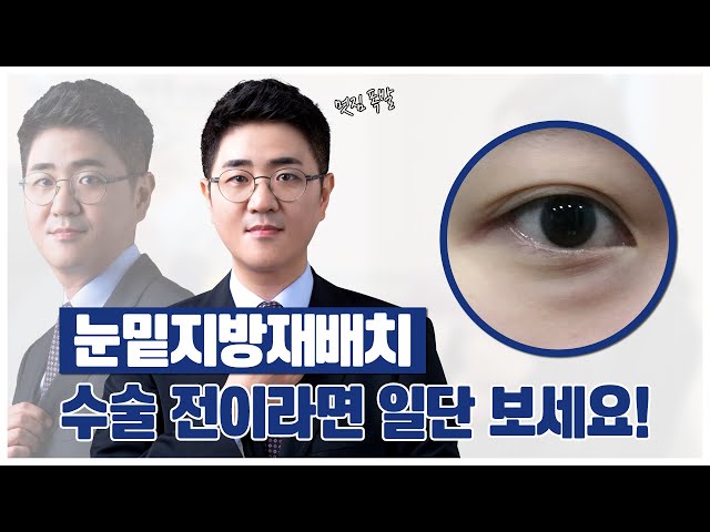 눈밑지방재배치 하기 전 확인해봐야 할 내용인데.. 보셨나요?🥸 l 압구정성형외과