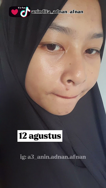 salep atau krim penghilang bekas luka