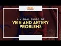 A Visual Guide to Vein and Artery Problems (PART 4) | Usapang Pangkalusugan