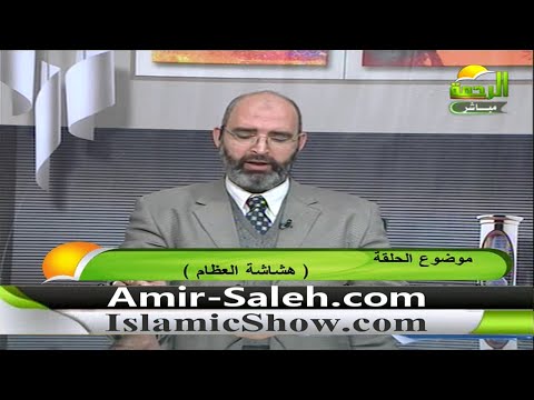 هشاشة العظام | الدكتور أمير صالح | الطب الآمن