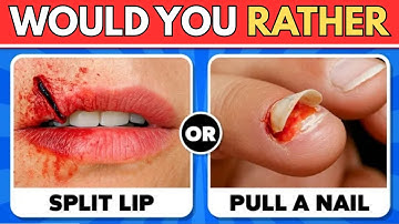 Would You Rather….? ⚠️ Hardest Choices Ever😱🔥 Extreme Edition 