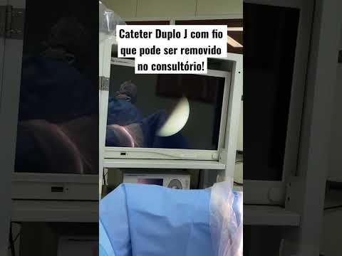 Vídeo: 3 maneiras de fazer xixi enquanto viaja de carro