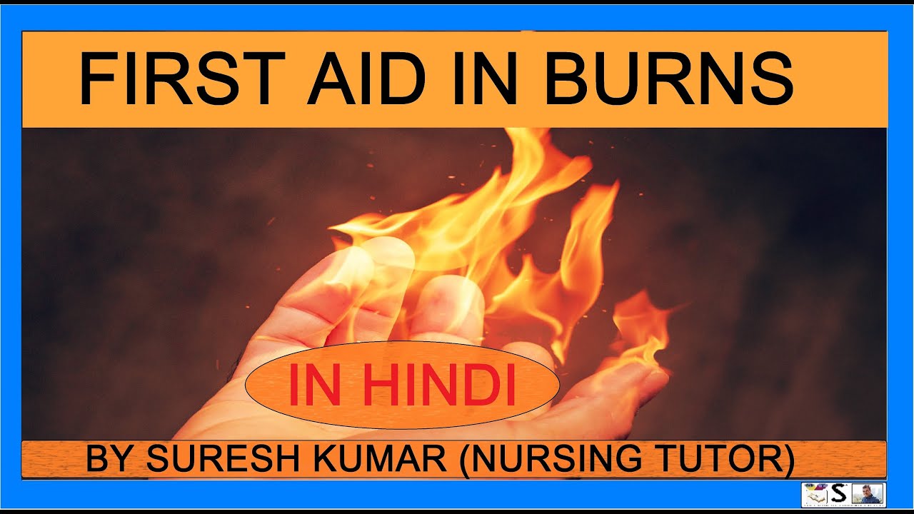 जलने की स्थिति में प्राथमिक चिकित्सा क्या प्रदान की जानी चाहिए | first aid in burn | fire (video lesson)