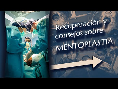 Video: ¿Es dolorosa la genioplastia deslizante?