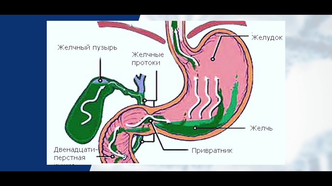 Пищевода тошнота