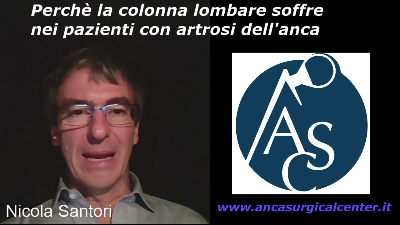 Perché la artrosi dell'anca aggrava l'equilibrio della colonna lombare