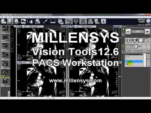 MILLENSYS Vision Tools MultiView 12.6 PACS Workstation
