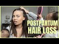 I'M BASICALLY GOING BALD: POSTPARTUM HAIR LOSS | Brittney Gray