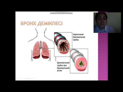 Бейне: Балада бронх демікпесін қалай емдеуге болады