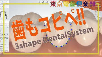歯もコピペ!! 3shape Dentalsystemの使い方for Dentist