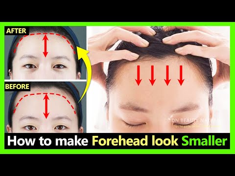How to fix big wide forehead, Make forehead smaller naturally | Shrink forehead with exercises