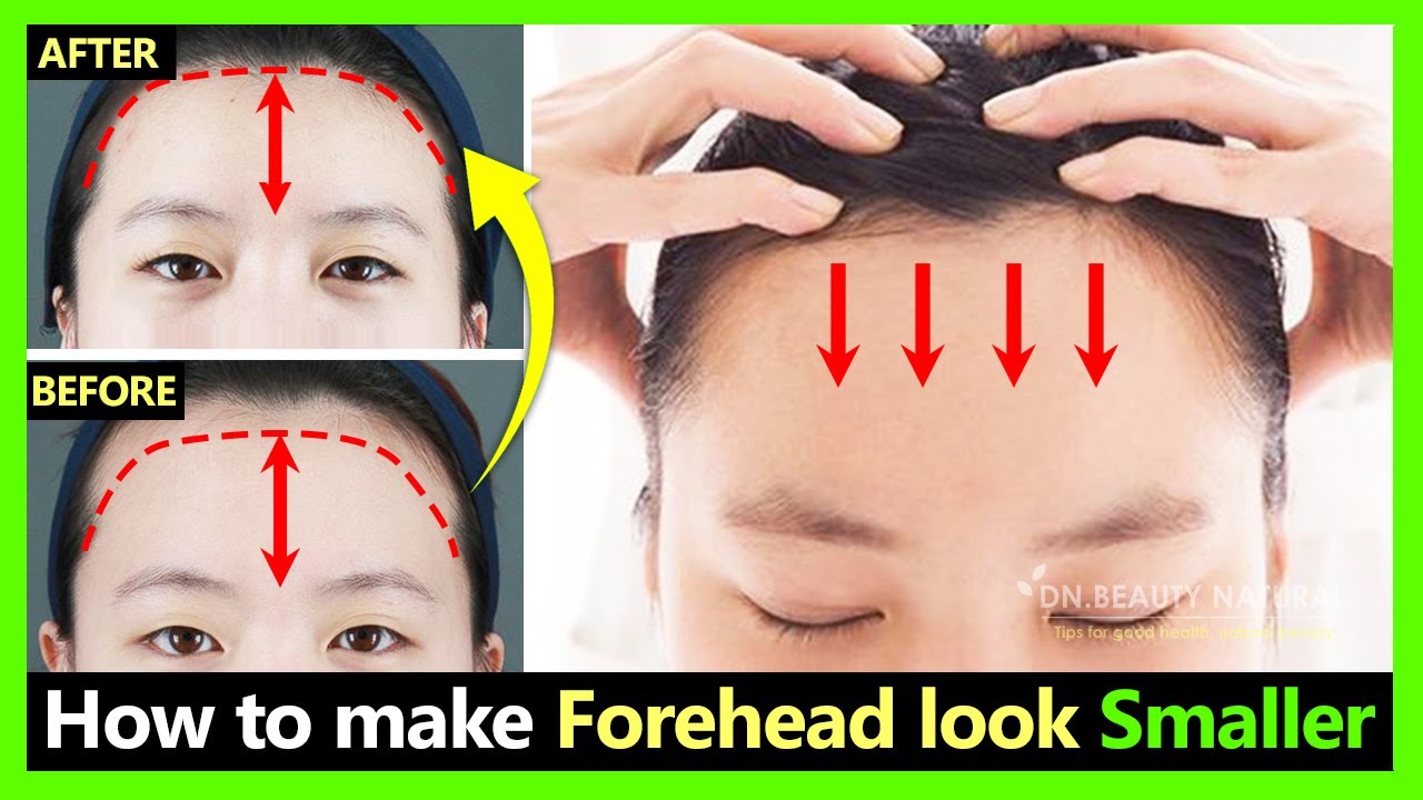 How To Fix Big Wide Forehead Make Forehead Smaller Naturally Shrink Forehead With Exercises Youtube