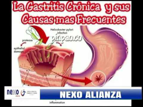 Cuidados de la gastritis